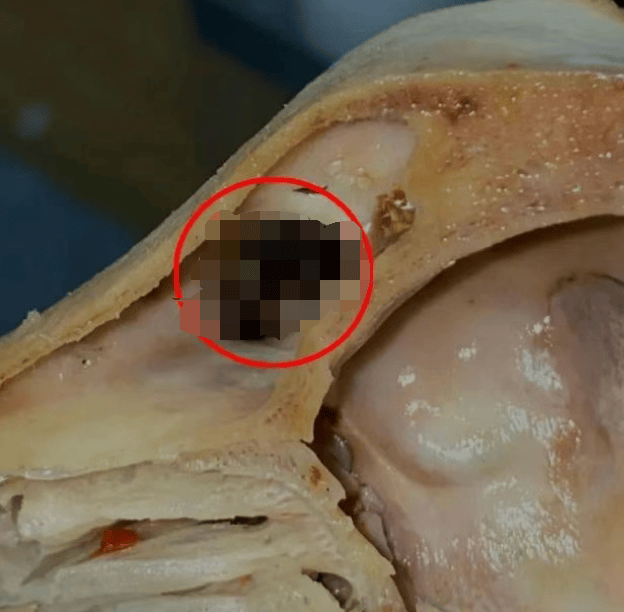 吃完发现全是蛆，恶心呕吐一整夜！上海法院判了：赔1000元